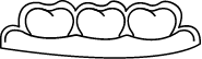 Ortodonzia trasparente invisalign
