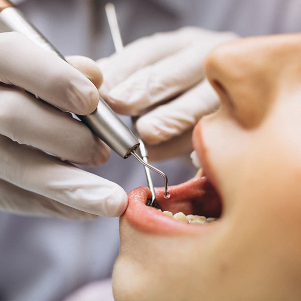 endodonzia dental cure sacchi cesano maderno