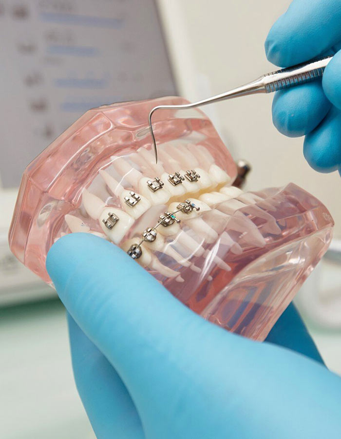 ortodonzia dental cure sacchi cesano maderno