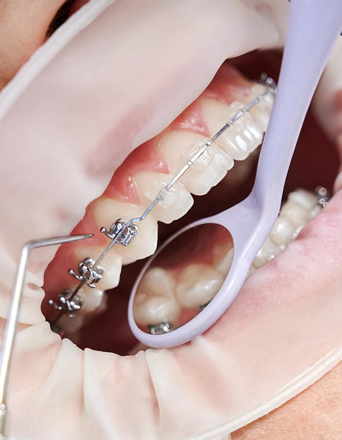 ortodonzia dental cure sacchi cesano maderno